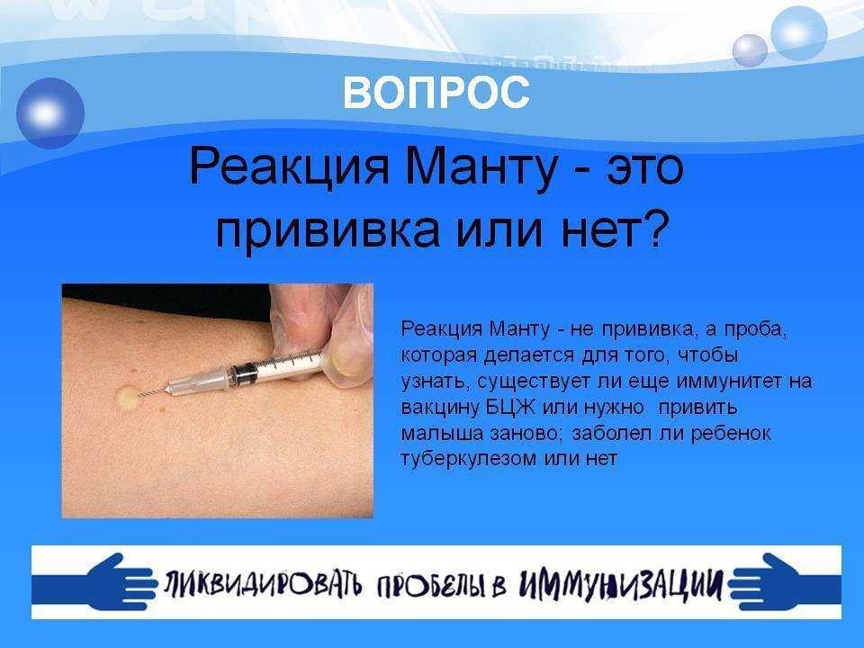 Проба манту при насморке: можно ли делать?