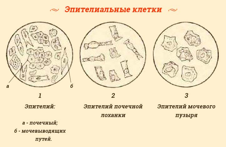 Эпителий кошки что это