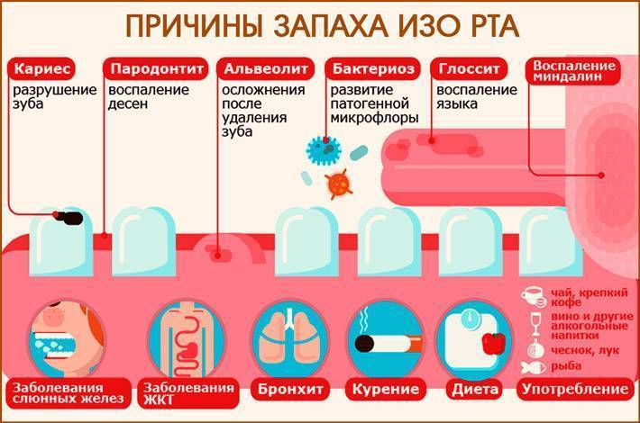 Появление неприятного запаха изо рта у детей: причины, лечение, профилактика
