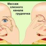 Массаж слезного канала у новорожденных и грудничков: его роль в лечении дакриоцистита, а также указания, как правильно его делать при непроходимости протока