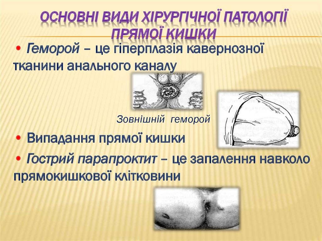 Парапроктит у грудничка фото - womenland