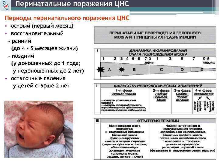 Симптомы и признаки неврологических отклонений у новорожденных