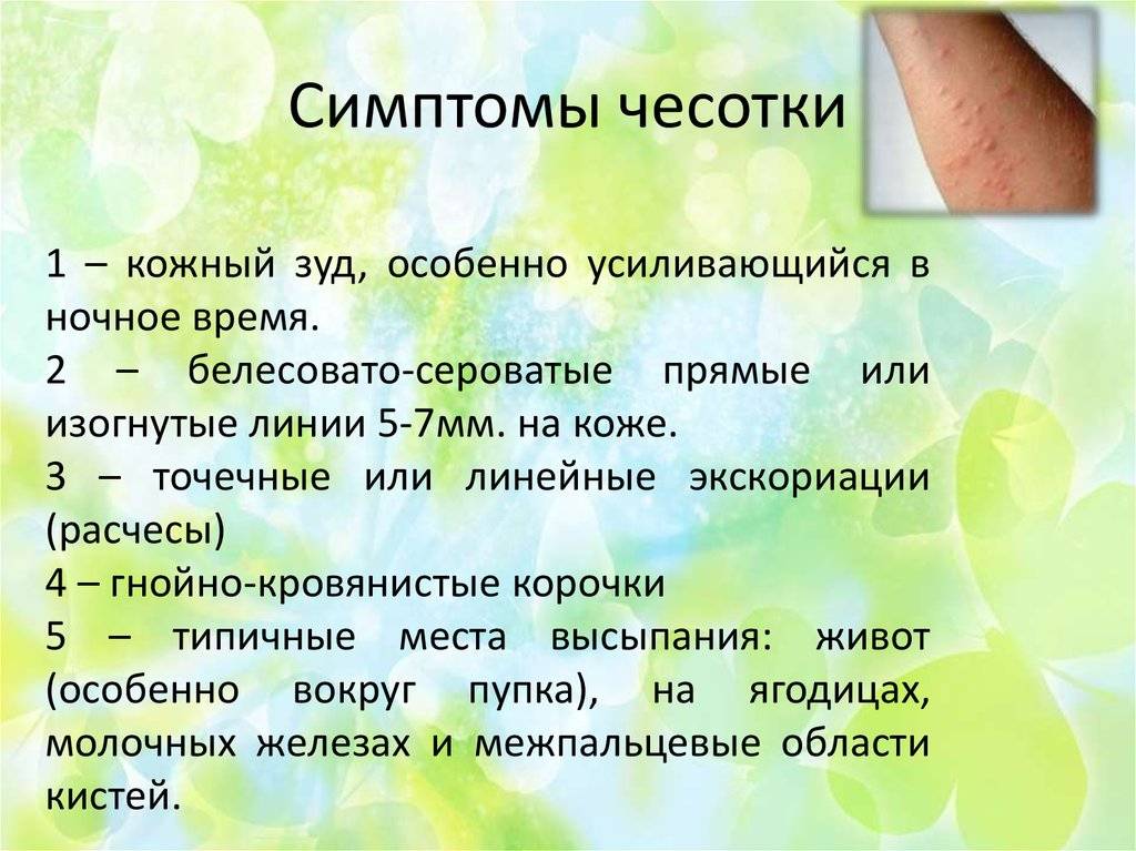 Лечение чесотки у детей - как и чем лечить заболевание