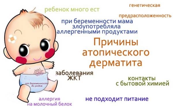 Причины, симптомы и виды дерматита у детей и новорожденных. методы лечения, кремы и мази от дерматита | qulady