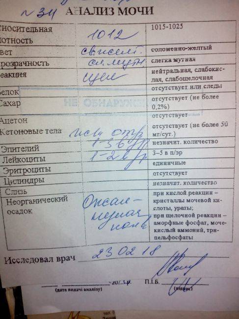 Соли в моче у ребенка
