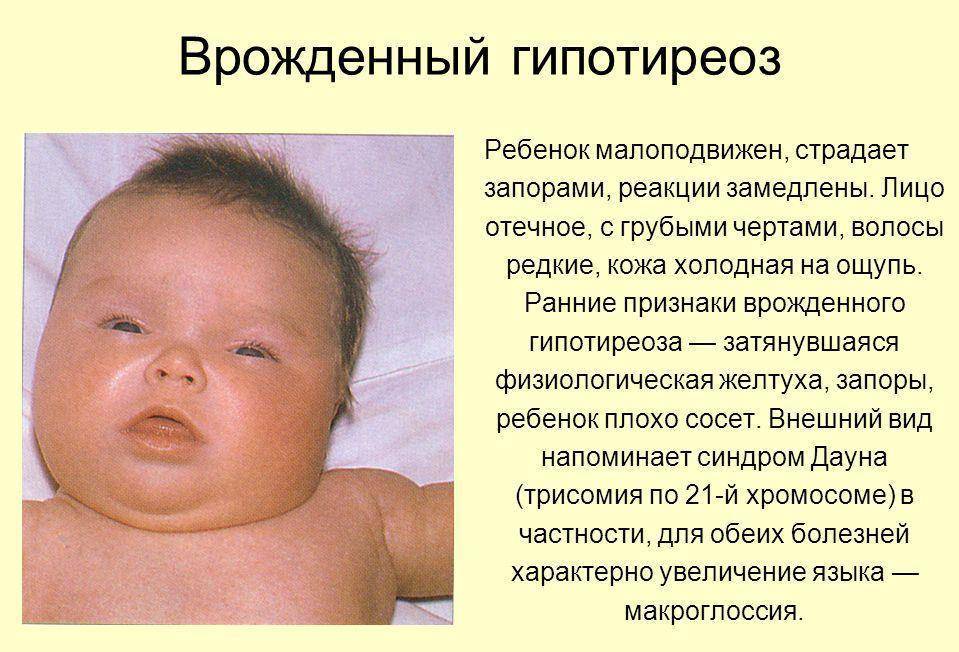 Слезится глаз у ребенка, появляются гнойные выделения: что делать родителям новорожденного?
