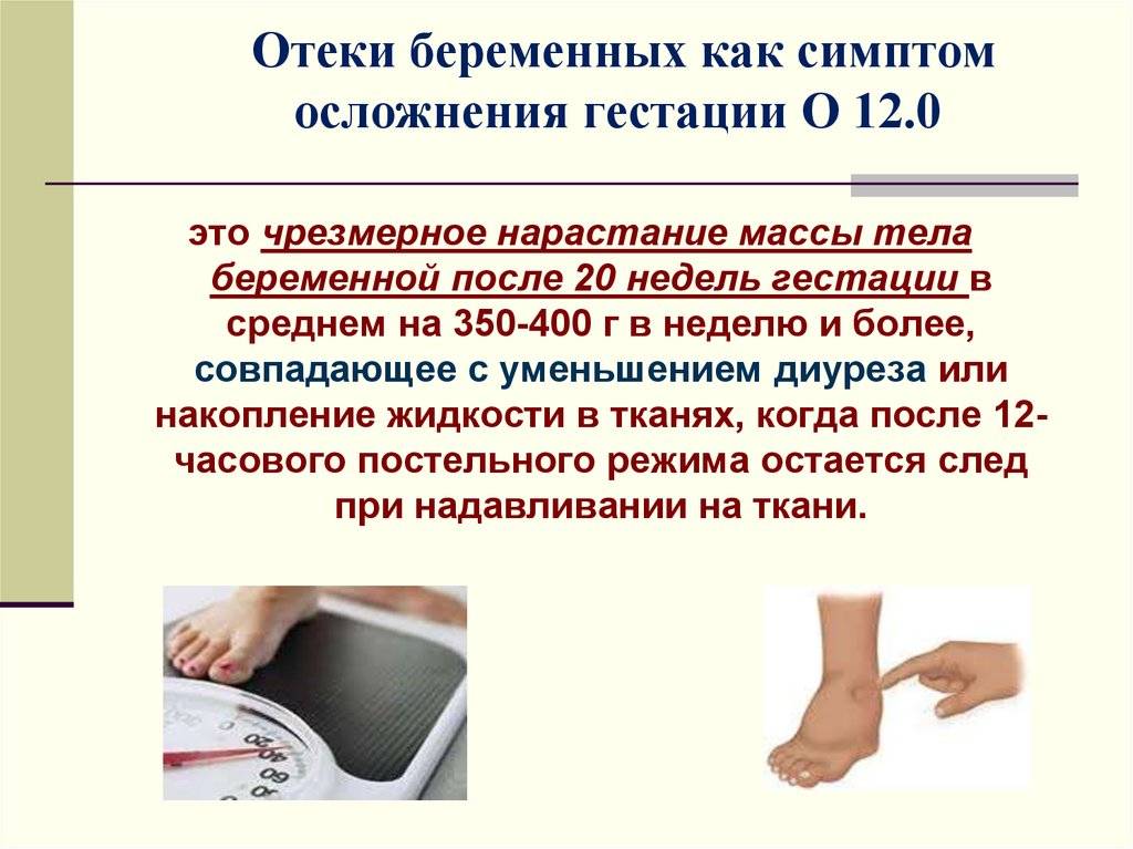 Отеки рук при беременности | уроки для мам