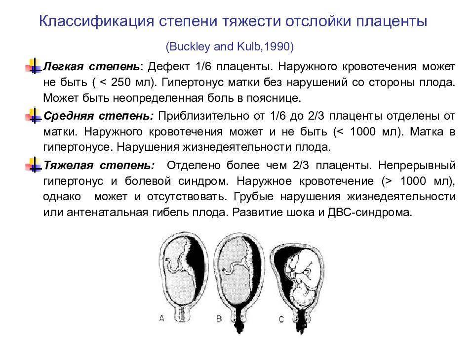 Отслойка плаценты - симптомы, диагностика, лечение