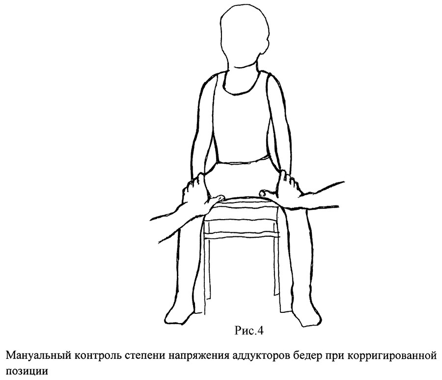 Вывих локтевого сустава у детей: лечение, осложнения