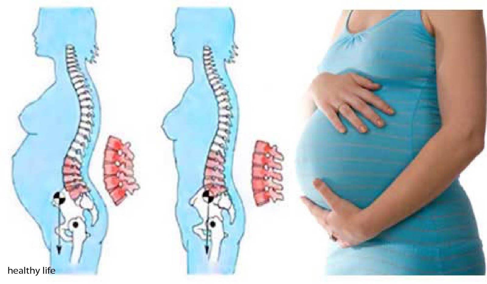 Вторая беременность болит поясница. Беременность и позвоночник. Позвоночник у беременных. Боли в пояснице при беременности. Спина при беременности.
