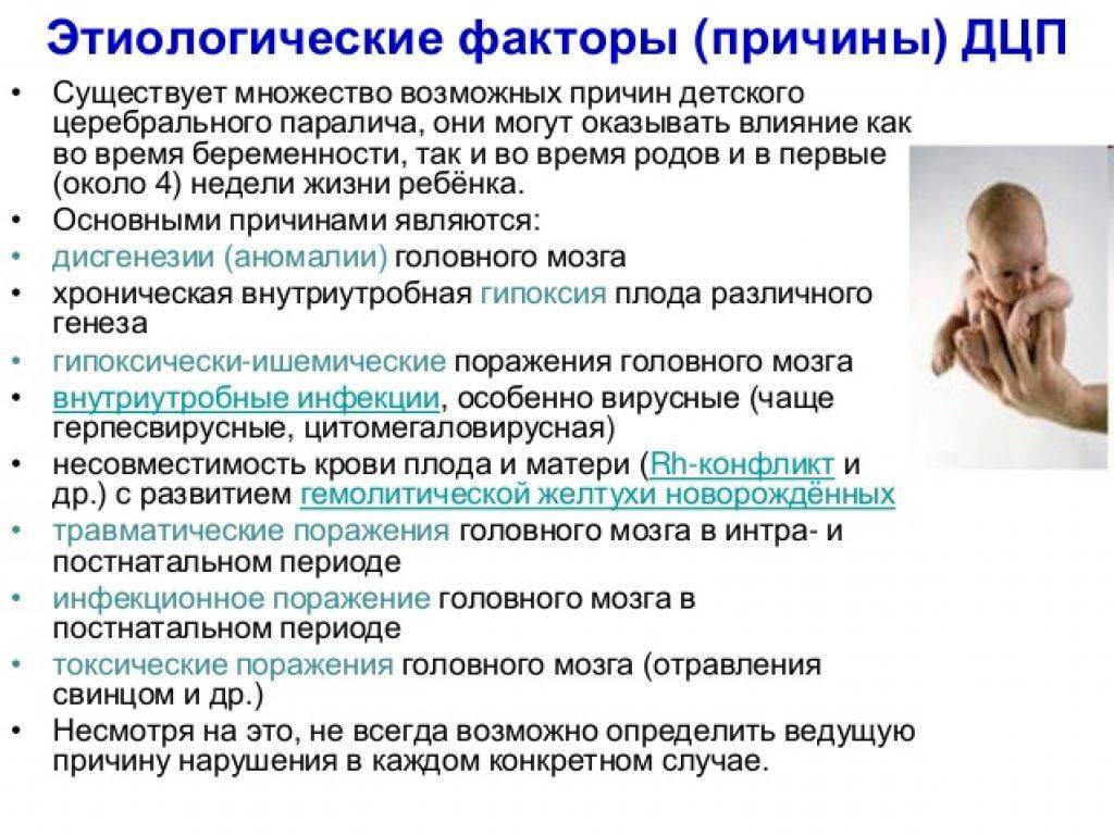Детский церебральный паралич (дцп) - причины, симптомы, диагностика, лечение