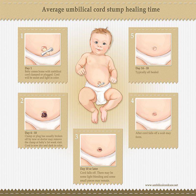 Пупок новорожденного: как обрабатывать, что делать если он гноится или кровит | азбука здоровья