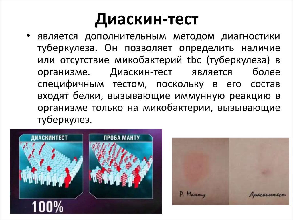 Диаскинтест: что это, оценка результатов, отличия от манту, отзывы