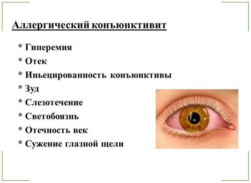 Аллергический конъюнктивит у детей: симптомы и методы лечения
