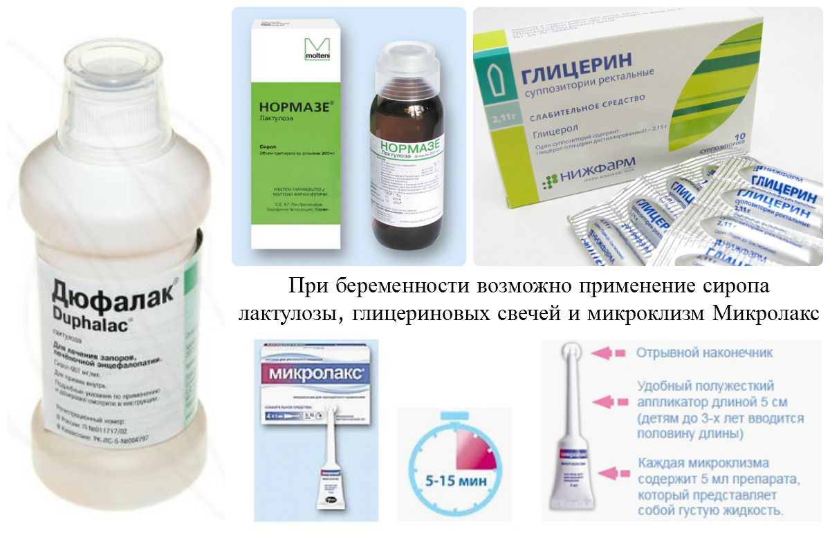 Запор после родов: что делать кормящей маме запор после родов – при грудном вскармливании, что делать, слабительные, свечи