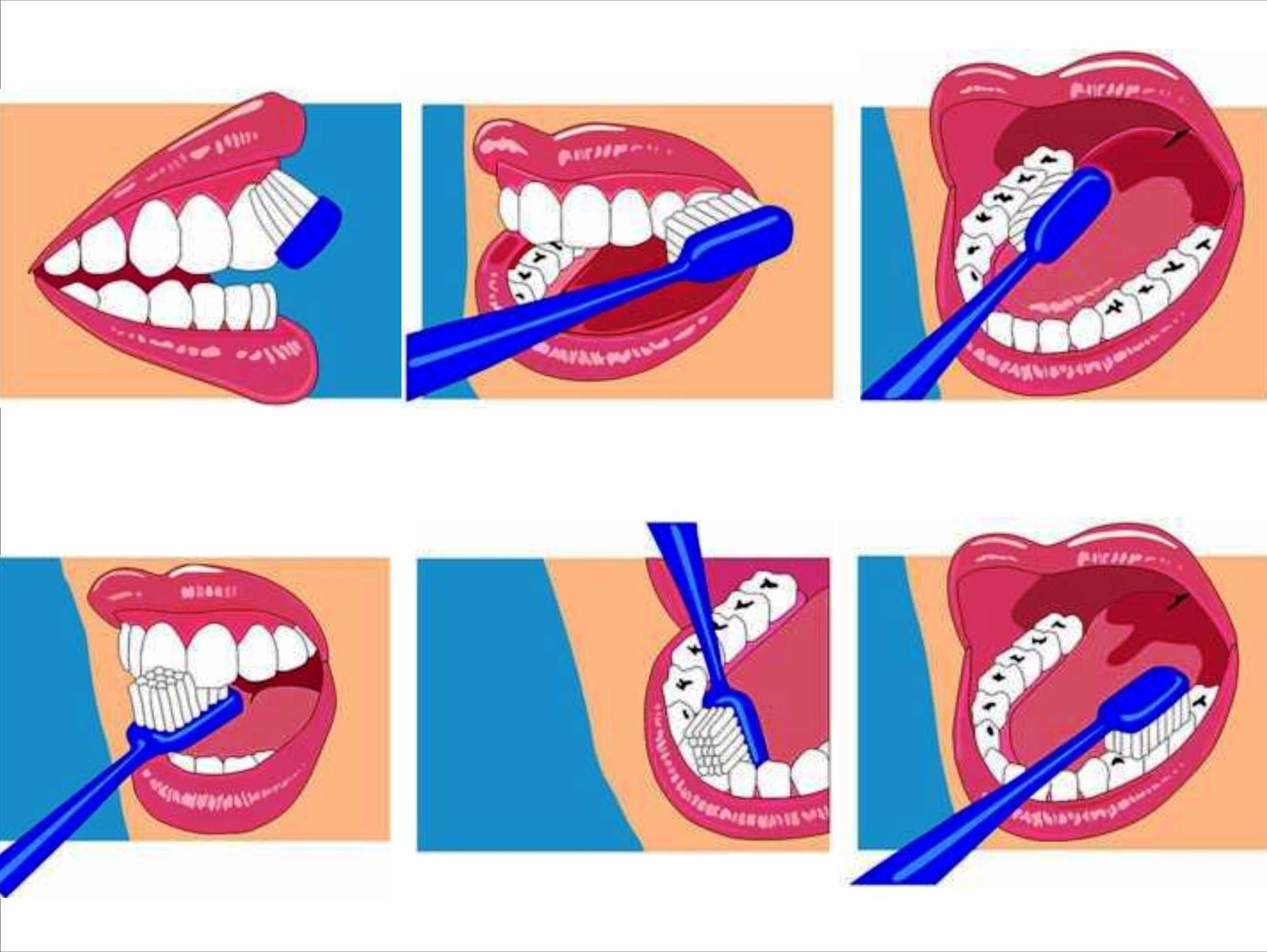 Когда лучше чистить зубы. Схема как правильно чистить зубы для детей. Правельна схема чистки зубов. Правильная методика чистки зубов зубной щёткой. Гигиена зубов схема.