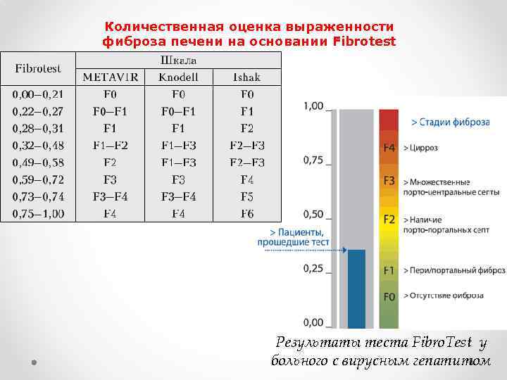 Особенности фиброза печени у детей и методы диагностики