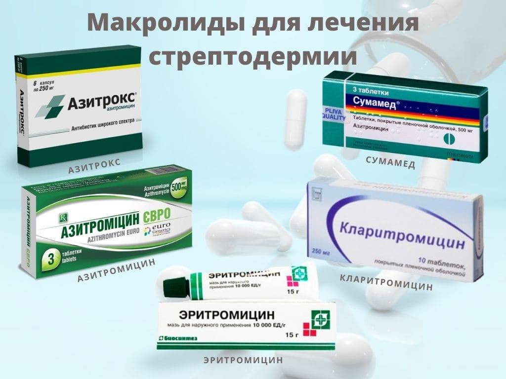 Стрептодермия у детей: лечение, диагностика, профилактика