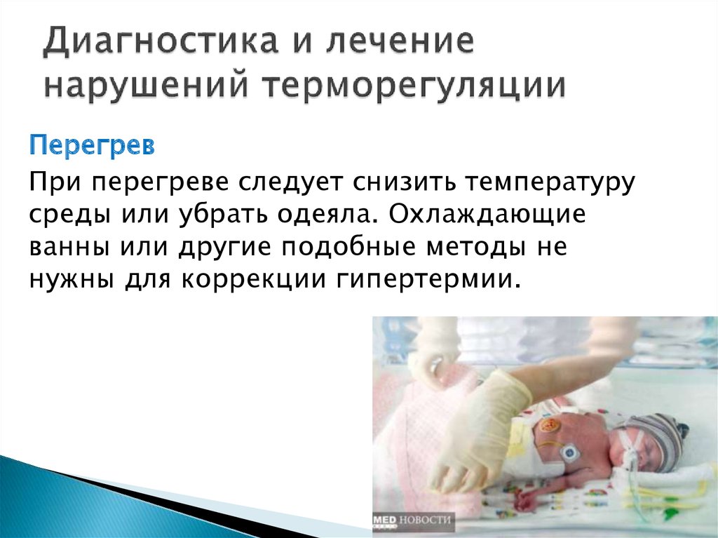 Ноги и руки холодные при температуре у ребенка: причины, опасность симптома, помощь малышу