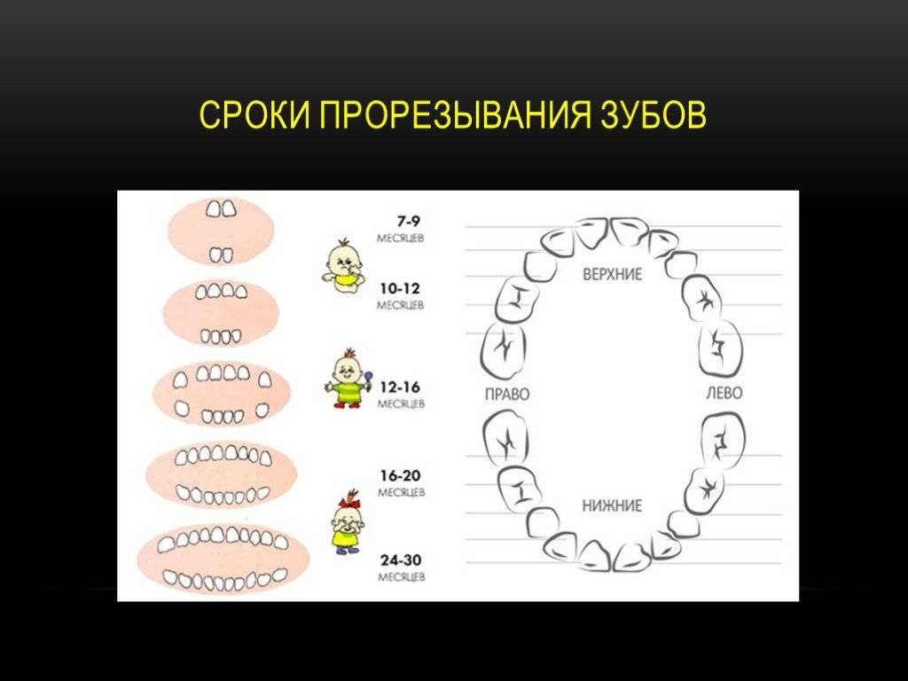 Порядок прорезывания зубов у детей: схема с фото