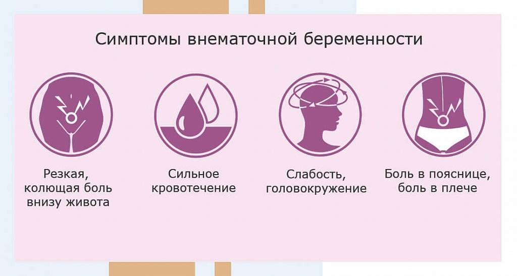 Как определить внематочную беременность: 11 шагов