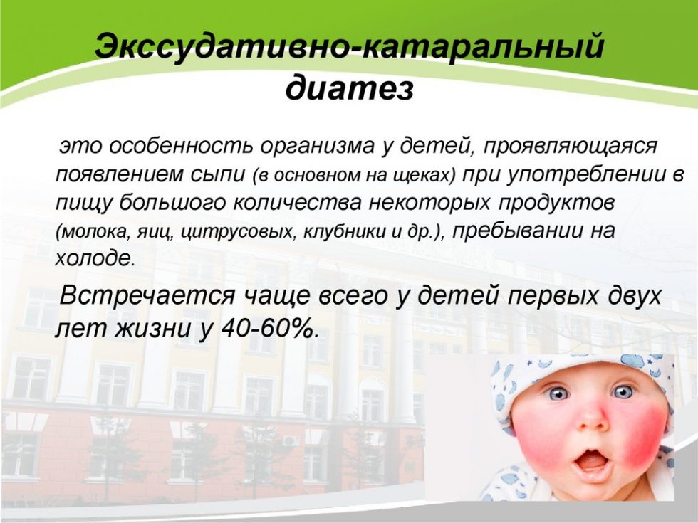 Диатезы