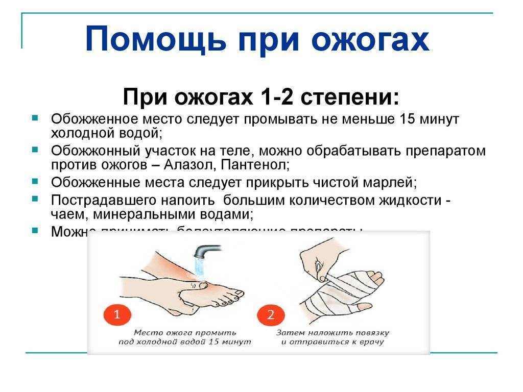 Ожоги у детей, первые 24 часа