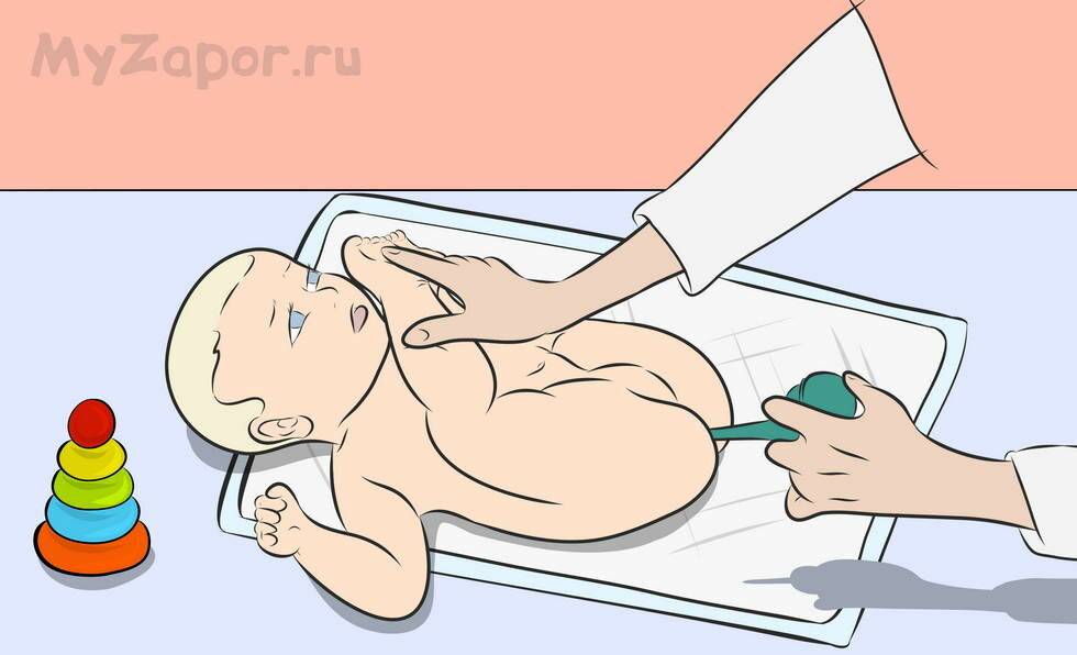 Как наладить пищеварение и работу кишечника и желудка, жкт. как улучшить, восстановить, нормализовать