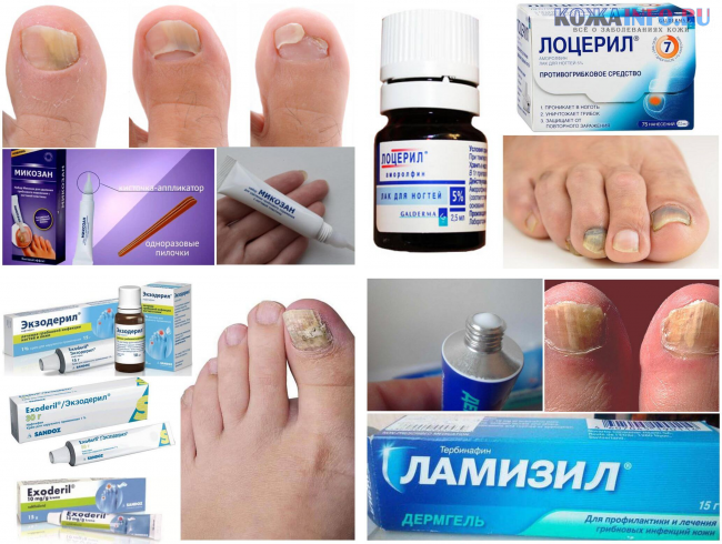 Экзодерил От Грибка Цена