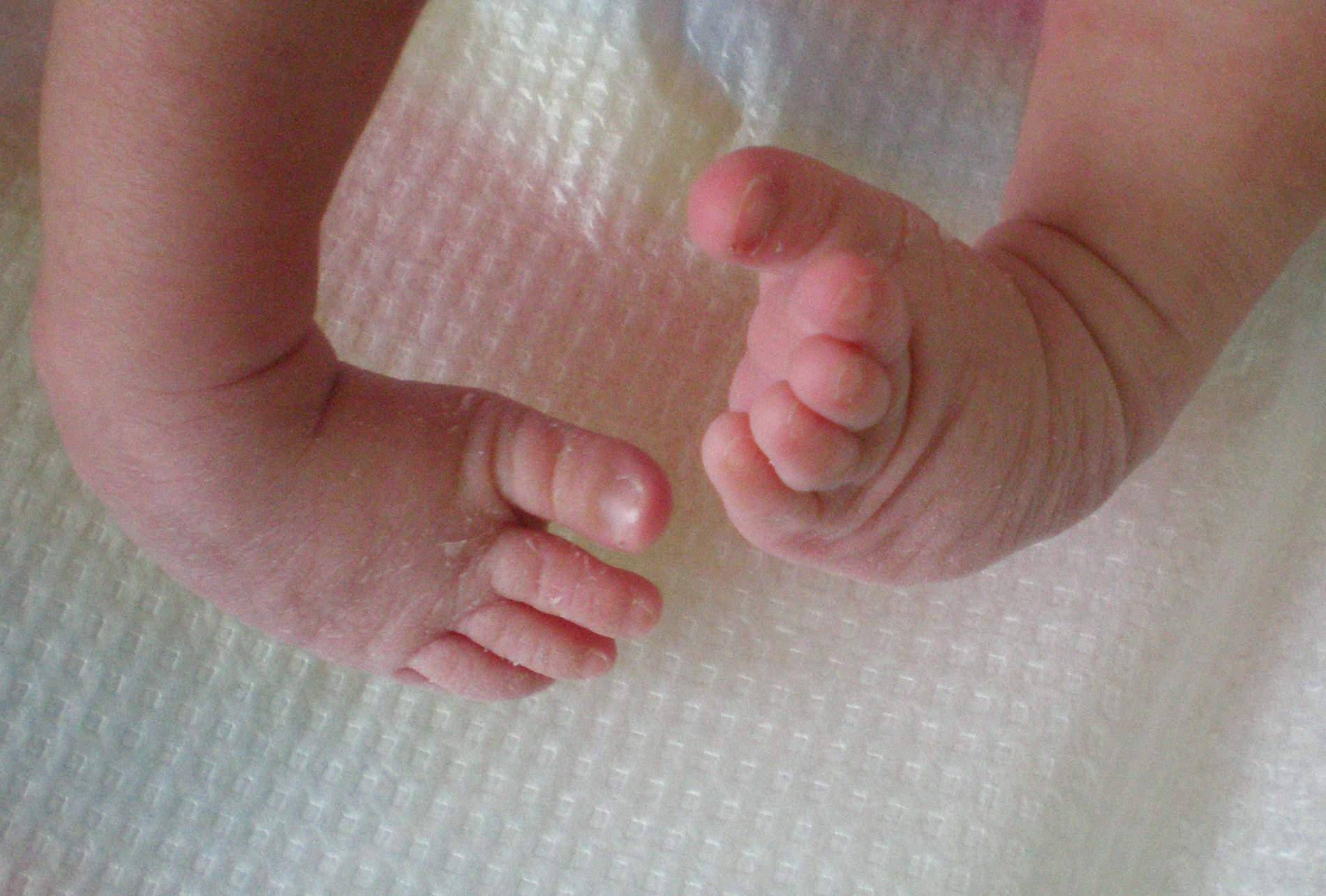 У новорожденного ребенка шелушится кожа на теле: почему она облазит, как за ней ухаживать?