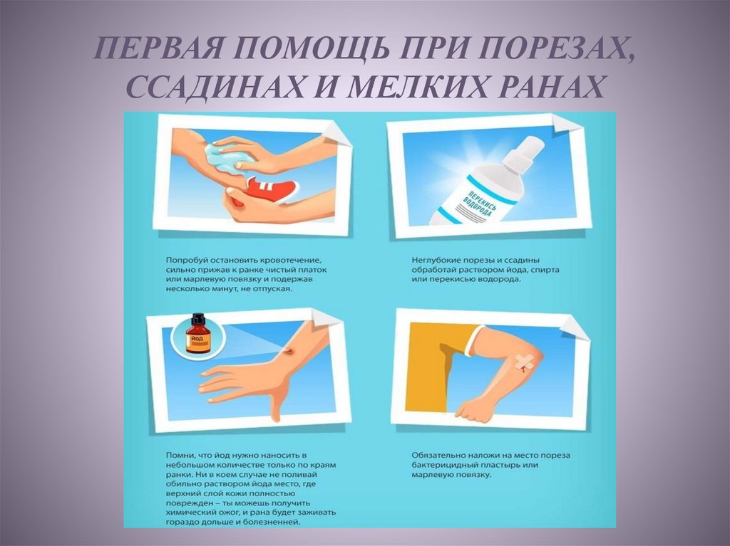 Порез у ребенка: как правильно обработать и лечить раны у детей