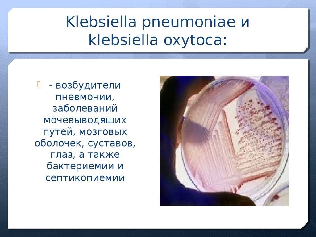 Клебсиелла – что это такое и пути передачи бактерии, симптомы, диагностика, лечение и профилактика