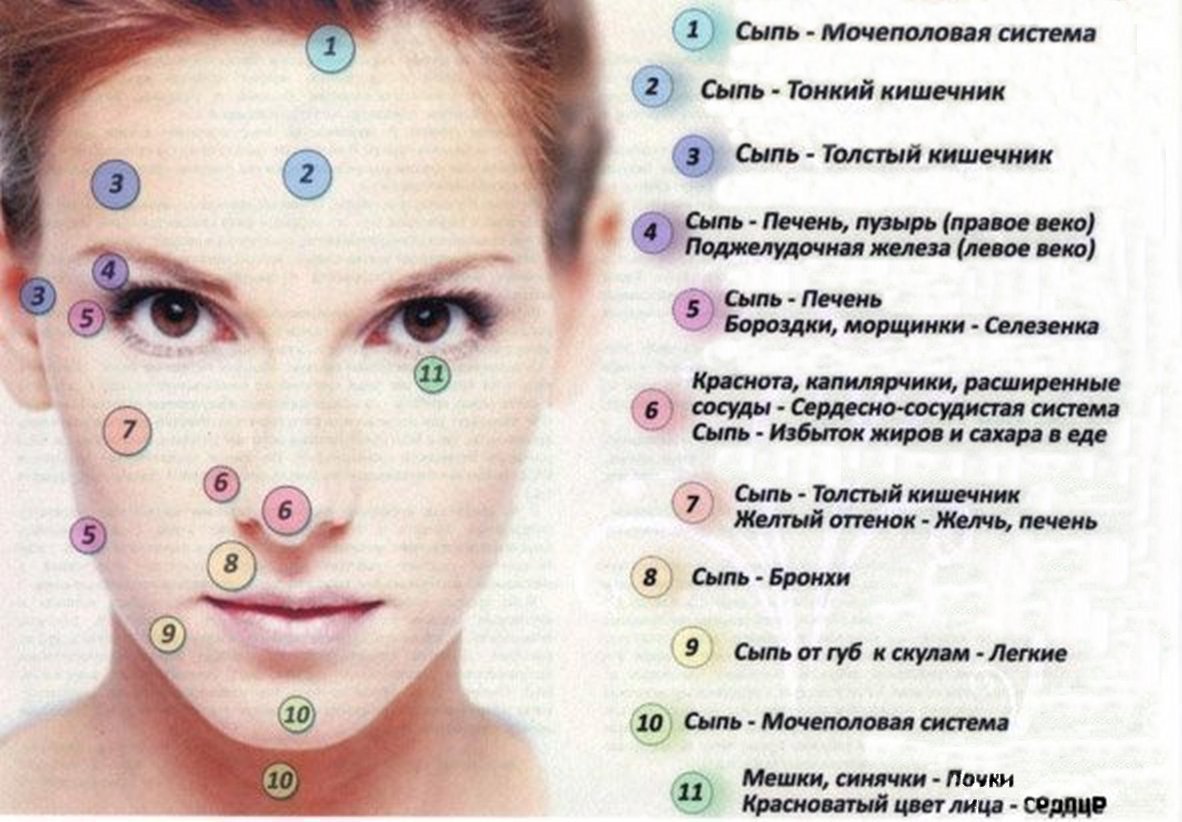 Прыщи у грудничков на лице: причины сыпи у новорожденных, лечение высыпаний у грудничков