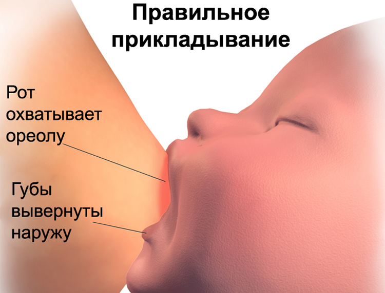 Боль при грудном вскармливании: из-за чего возникает, как ее устранить