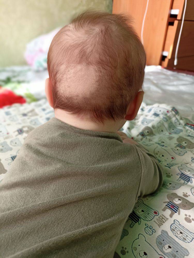 Почему выпадают волосы у грудничка, опасно ли это? · всё о беременности, родах, развитии ребенка, а также воспитании и уходе за ним на babyzzz.ru