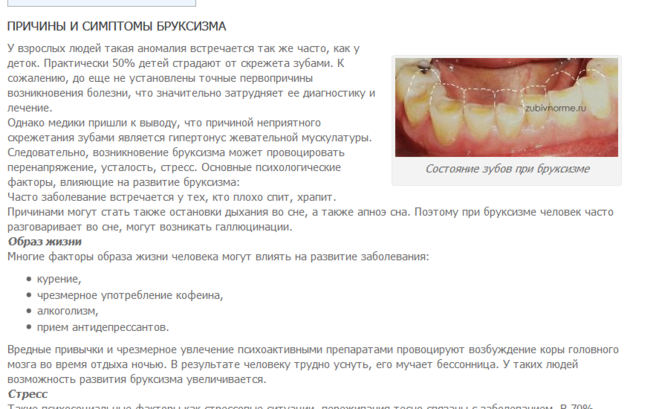 Что означает когда снятся зубы