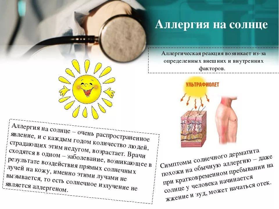 Аллергия на солнце у детей и 10 способов её предотвращение от педиатра