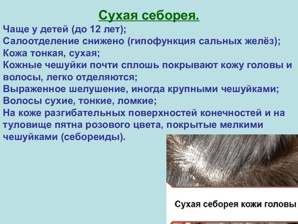 Корочки на голове у грудничка или новорожденного: как и чем убрать + мнение доктора комаровского