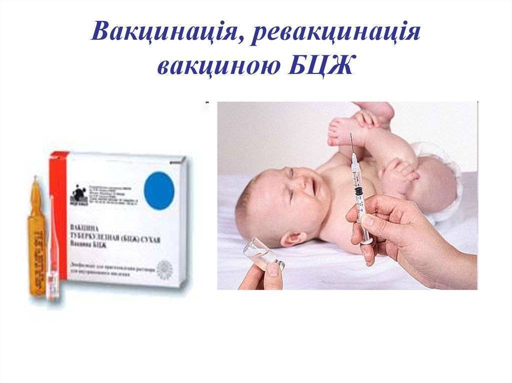Реакция на прививку бцж у грудничка: как проявляется, чего ожидать