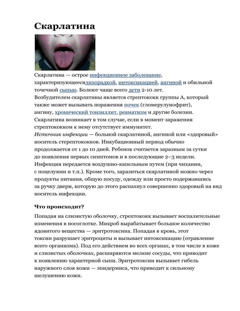 Что такое скарлатина и как с ней бороться? - клиника в уручье