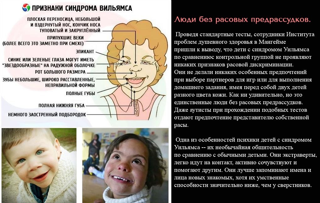 Синдром уильямса или ребенок с лицом эльфа