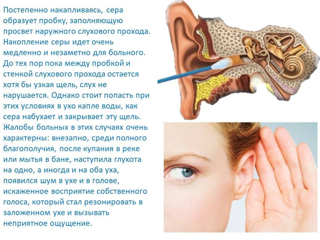 Синусит при беременности
