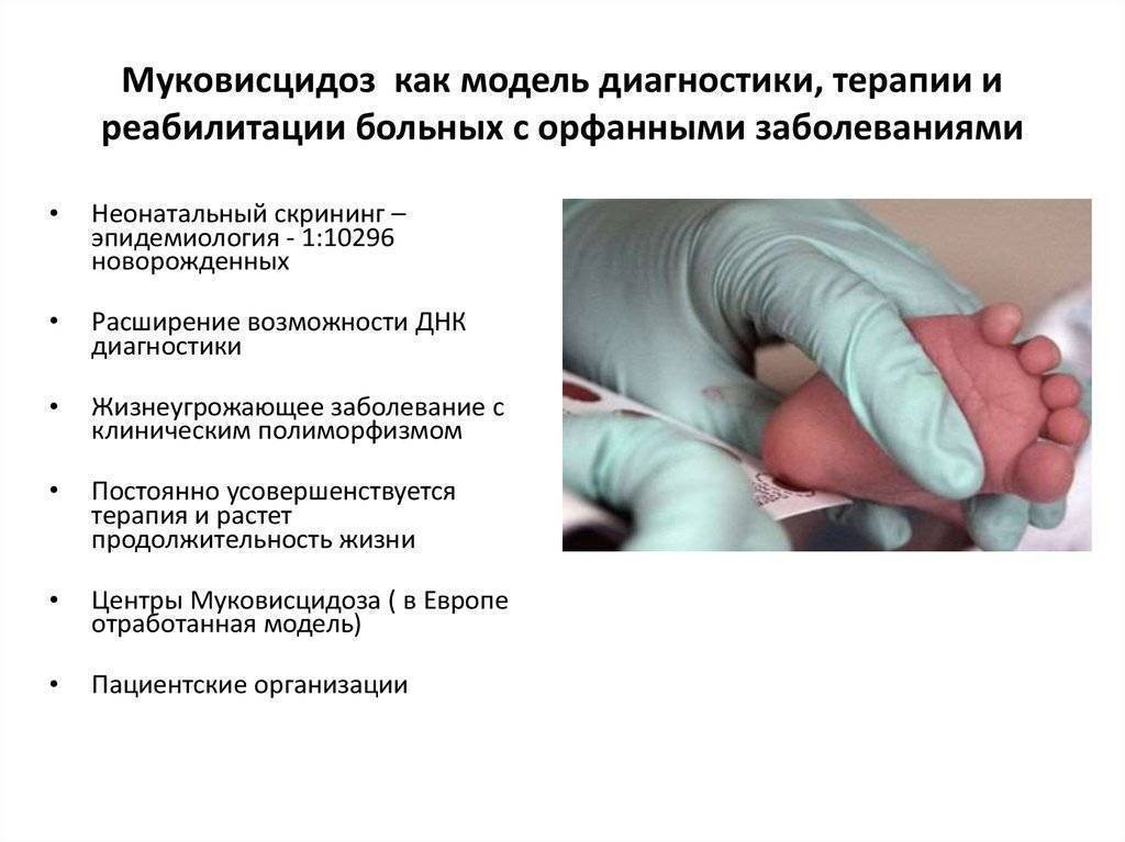 Муковисцидоз у грудных детей: симптомы и лечение