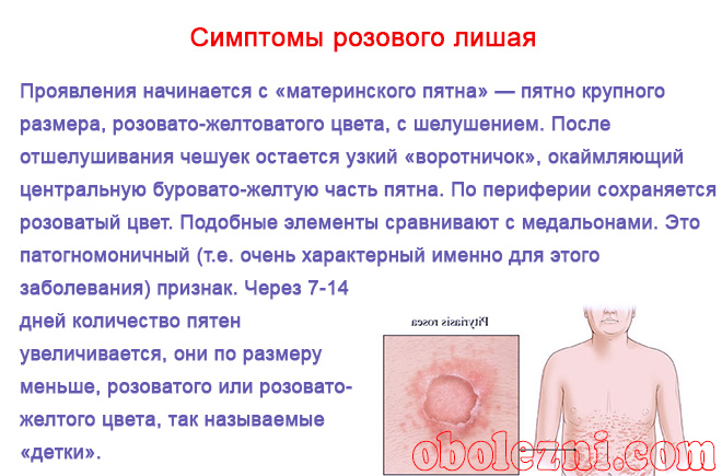 Герпес у детей