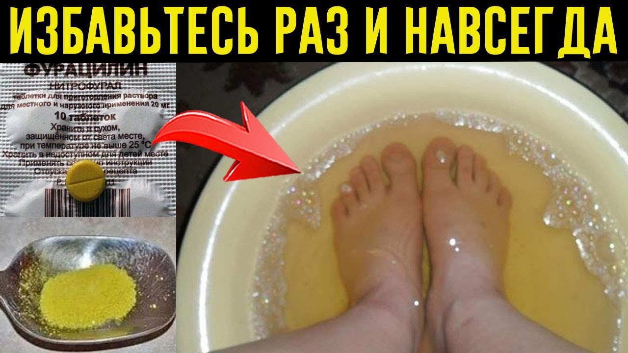 Как избавиться от запаха ног: народные средства и советы