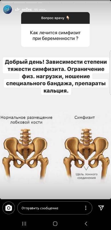 Почему болит лобковая кость при беременности / mama66.ru