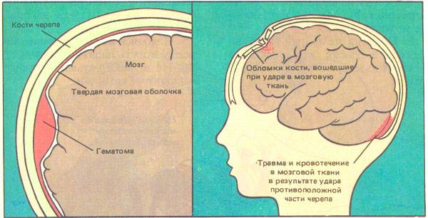 Ребенок упал с дивана вниз головой - комаровский рассказывает, что делать при падении с кровати