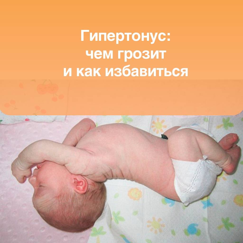 Гипертонус у новорожденного не диагноз: причины и способы решения проблемы