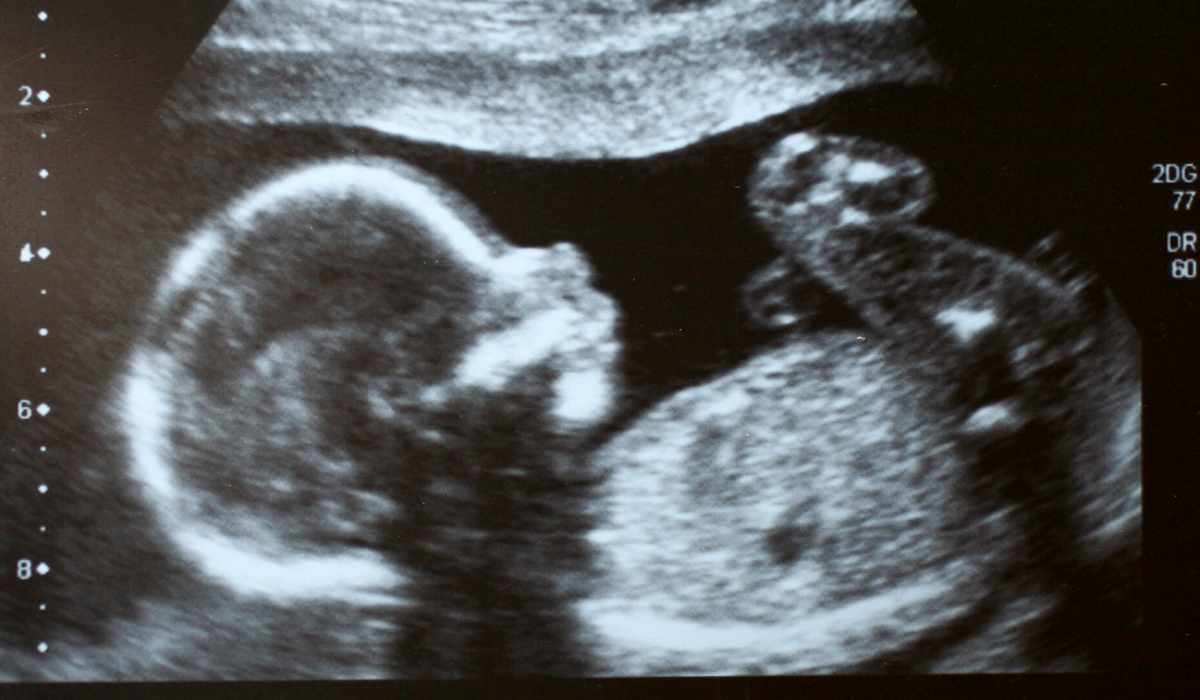 фото ребенка в животе 19 недель