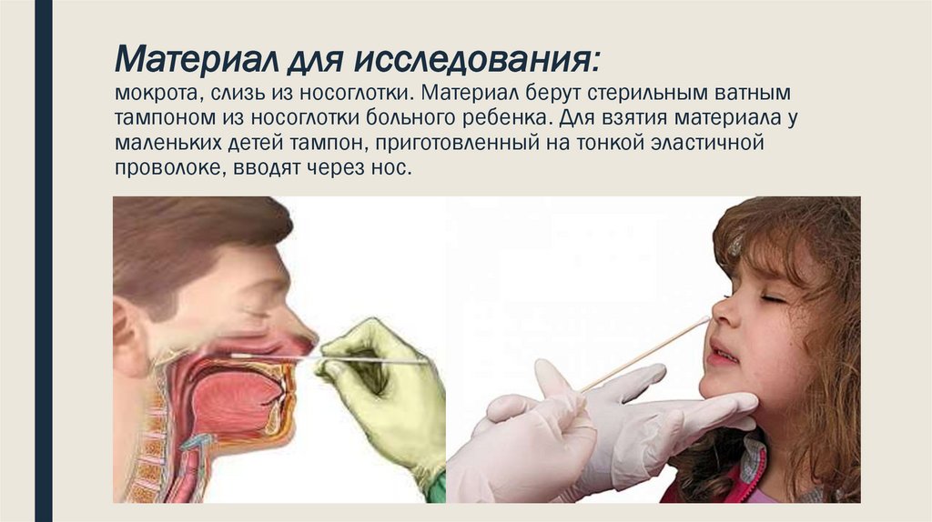 Кашель с мокротой у грудничка